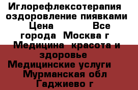Иглорефлексотерапия, оздоровление пиявками › Цена ­ 3 000 - Все города, Москва г. Медицина, красота и здоровье » Медицинские услуги   . Мурманская обл.,Гаджиево г.